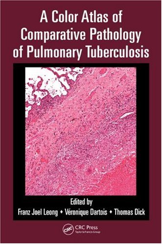 A Color Atlas of Comparative Pathology of Pulmonary Tuberculosis 2010