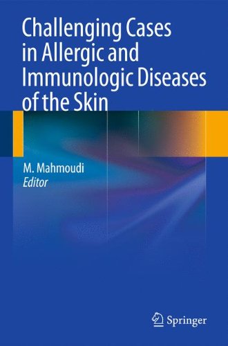 Challenging Cases in Allergic and Immunologic Diseases of the Skin 2010