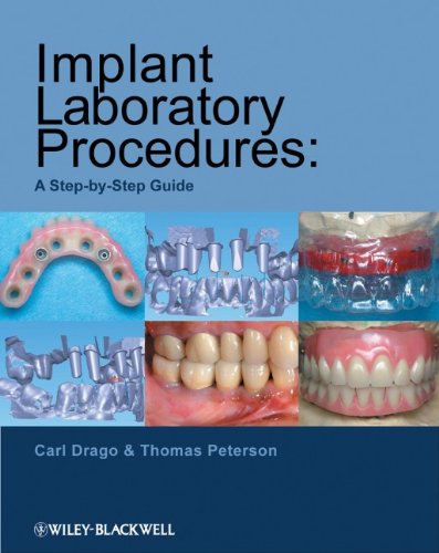 Implant Laboratory Procedures: A Step-by-Step Guide 2010