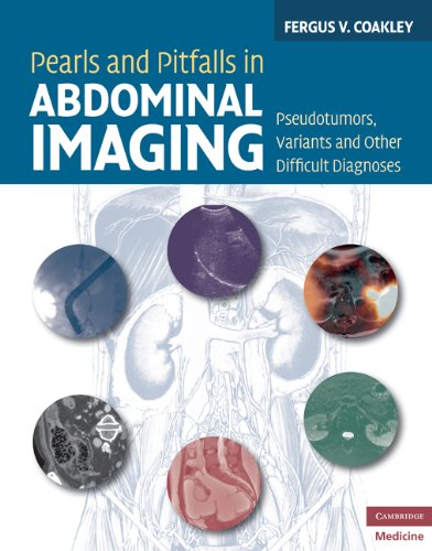 Pearls and Pitfalls in Abdominal Imaging: Pseudotumors, Variants and Other Difficult Diagnoses 2010