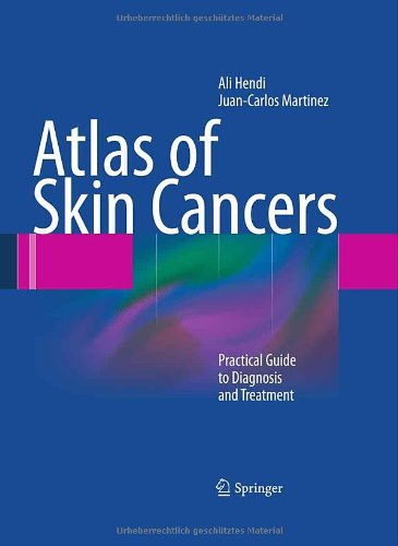 Atlas of Skin Cancers: Practical Guide to Diagnosis and Treatment 2011