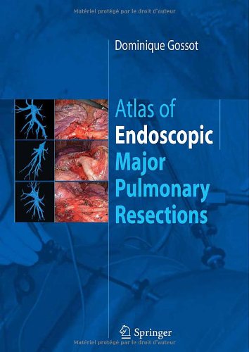 Atlas of endoscopic major pulmonary resections 2010