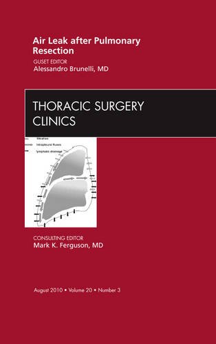 Air Leak After Pulmonary Resection, an Issue of Thoracic Surgery Clinics 2010