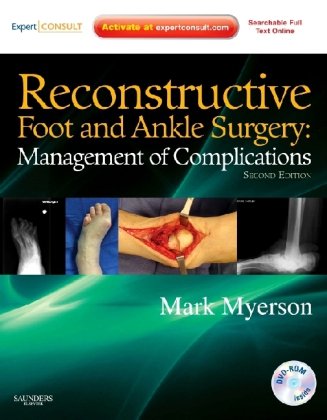 Reconstructive Foot and Ankle Surgery: Management of Complications 2010