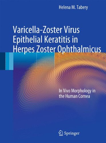 Varicella-Zoster Virus Epithelial Keratitis in Herpes Zoster Ophthalmicus: In Vivo Morphology in the Human Cornea 2011