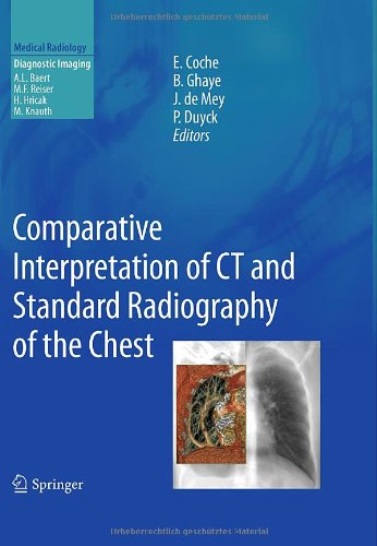 Comparative Interpretation of CT and Standard Radiography of the Chest 2011
