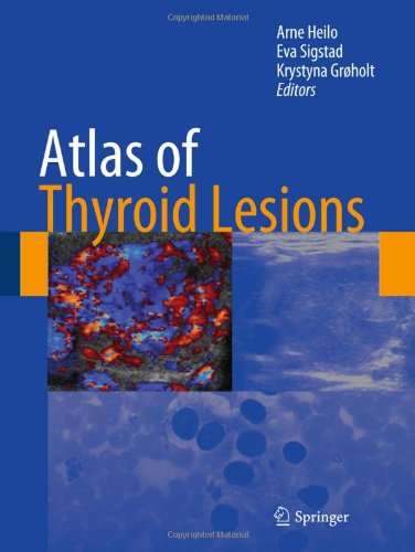 Atlas of Thyroid Lesions 2010