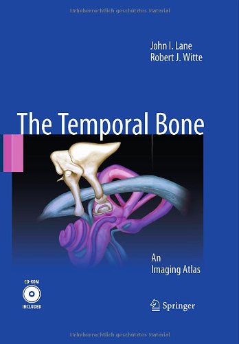 Temporal Bone: An Imaging Atlas 2010