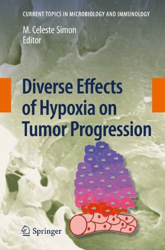 اثرات متنوع هیپوکسی بر پیشرفت تومور