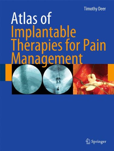 Atlas of Implantable Therapies for Pain Management 2010