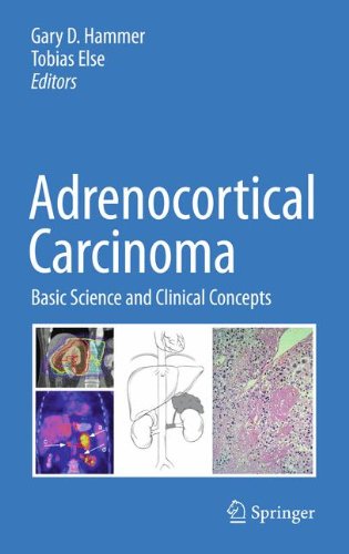 Adrenocortical Carcinoma: Basic Science and Clinical Concepts 2010