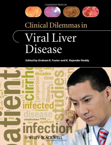 Clinical Dilemmas in Viral Liver Disease 2010
