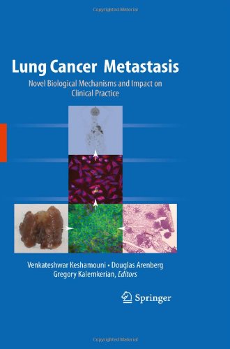 Lung Cancer Metastasis: Novel Biological Mechanisms and Impact on Clinical Practice 2009