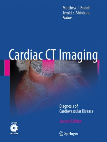 Cardiac CT Imaging: Diagnosis of Cardiovascular Disease 2010