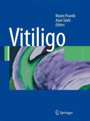 Vitiligo 2009