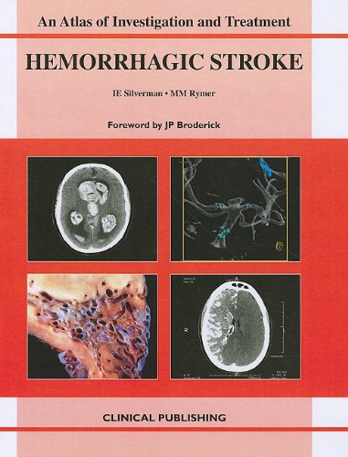 Hemorrhagic Stroke: An Atlas of Investigation and Treatment 2010