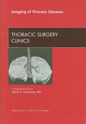 Imaging of Thoracic Diseases 2010