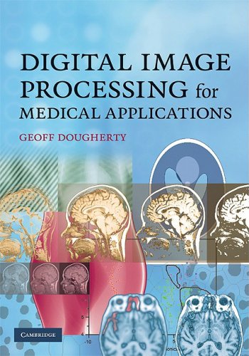 Digital Image Processing for Medical Applications 2009