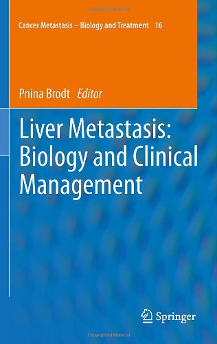 Liver Metastasis: Biology and Clinical Management 2011