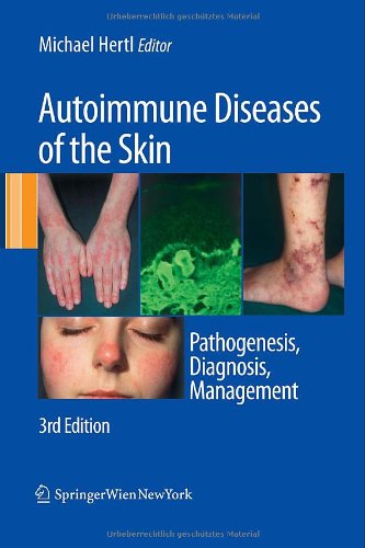 Autoimmune Diseases of the Skin: Pathogenesis, Diagnosis, Management 2010