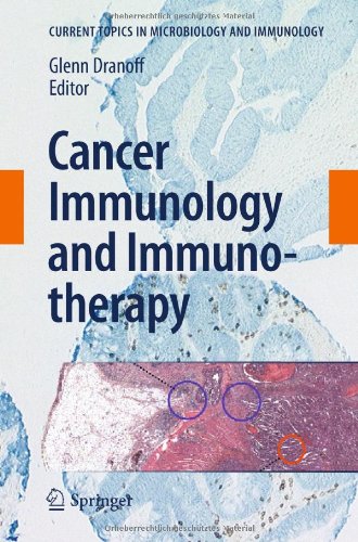 Cancer Immunology and Immunotherapy 2011