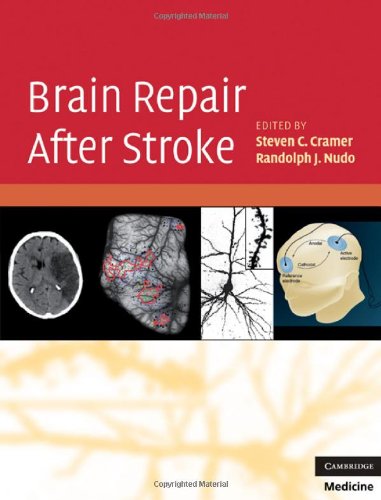 Brain Repair After Stroke 2010