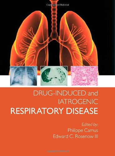 Drug-induced and Iatrogenic Respiratory Disease 2010