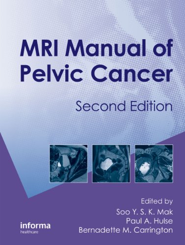 MRI Manual of Pelvic Cancer,Second Edition 2011