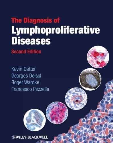 The Diagnosis of Lymphoproliferative Diseases 2011
