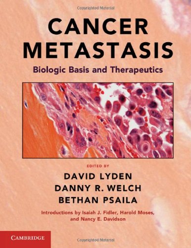 Cancer Metastasis: Biologic Basis and Therapeutics 2011