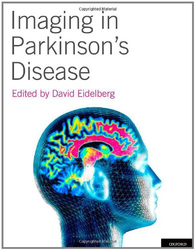 تصویربرداری در بیماری پارکینسون