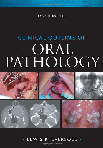 Clinical Outline of Oral Pathology: Diagnosis and Treatment 2011