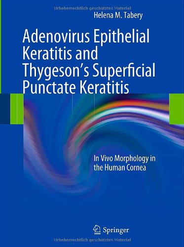Adenovirus Epithelial Keratitis and Thygeson's Superficial Punctate Keratitis: In Vivo Morphology in the Human Cornea 2011