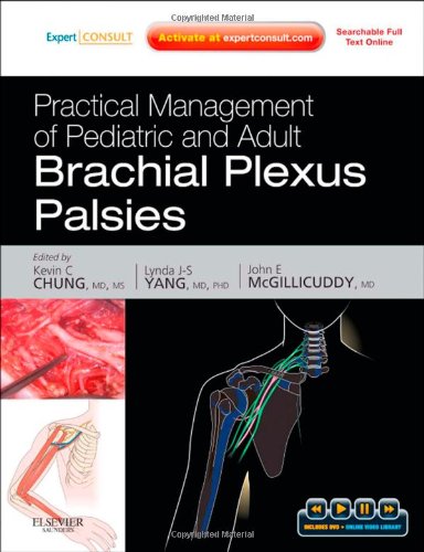 Practical Management of Pediatric and Adult Brachial Plexus Palsies 2011
