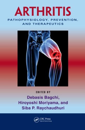 Arthritis: Pathophysiology, Prevention, and Therapeutics 2011