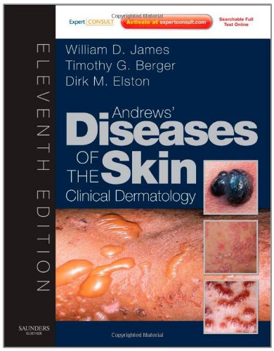 Andrews' Diseases of the Skin: Clinical Dermatology 2011