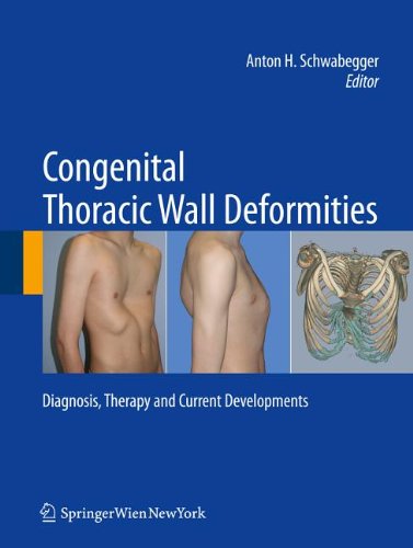 Congenital Thoracic Wall Deformities: Diagnosis, Therapy and Current Developments 2011
