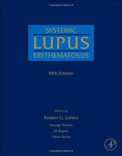 Systemic Lupus Erythematosus 2010