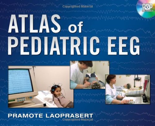 Atlas of Pediatric EEG 2011