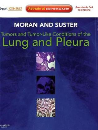 Tumors and Tumor-like Conditions of the Lung and Pleura 2010
