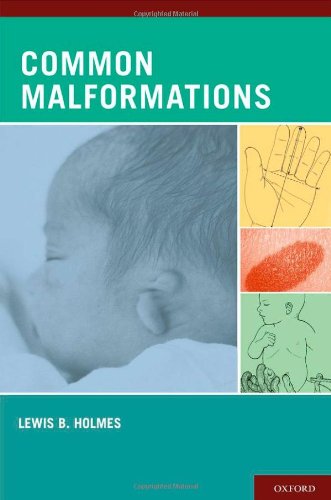 Common Malformations 2011