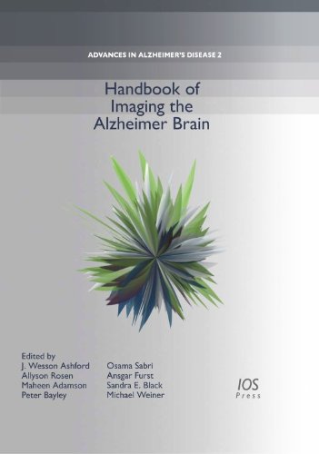 کتاب تصویربرداری مغز آلزایمر
