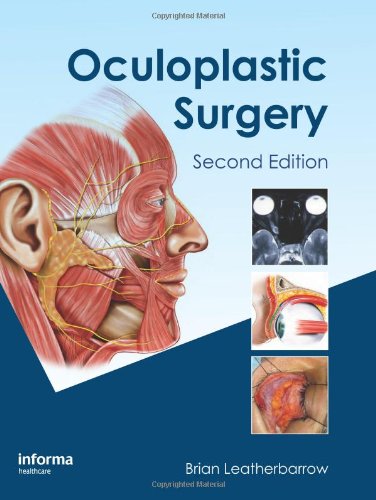 Oculoplastic Surgery, Second Edition 2010