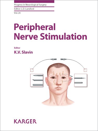 Peripheral Nerve Stimulation 2011
