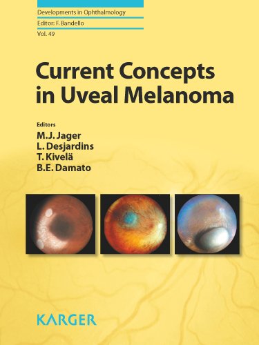 Current Concepts in Uveal Melanoma 2012