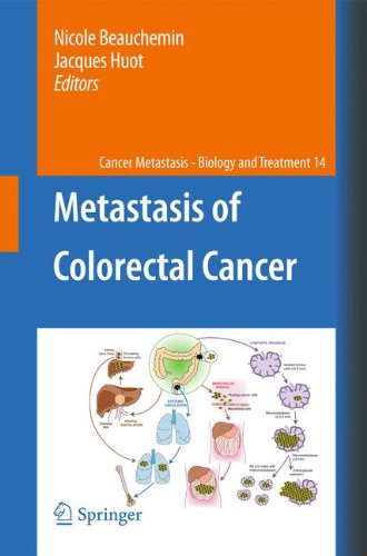 Metastasis of Colorectal Cancer 2010