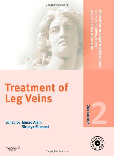 Treatment of Leg Veins 2010