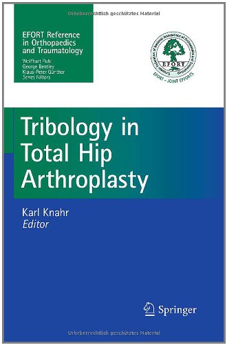 Tribology in Total Hip Arthroplasty 2011