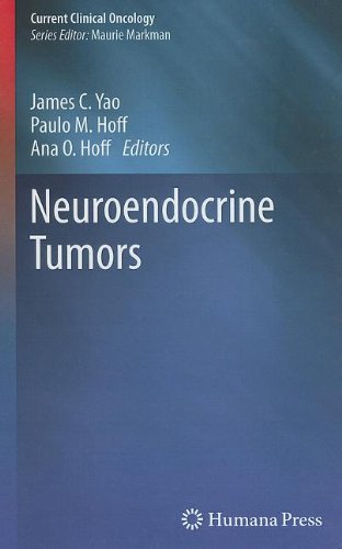 Neuroendocrine Tumors 2011