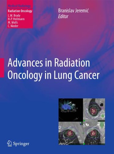 Advances in Radiation Oncology in Lung Cancer 2011